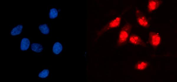 Anti-GCKR Antibody