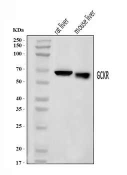 Anti-GCKR Antibody