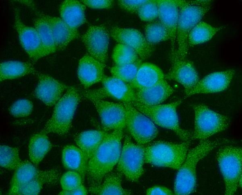 Anti-GGA3 Antibody