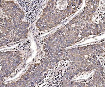 Anti-GGA3 Antibody