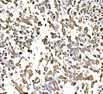 Anti-GGA3 Antibody