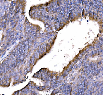 Anti-GGA3 Antibody