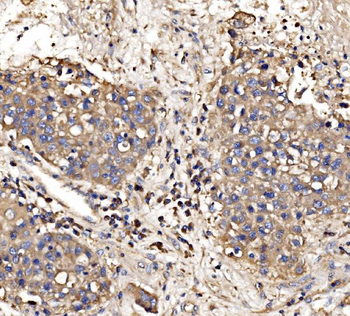 Anti-Gephyrin/GPHN Antibody