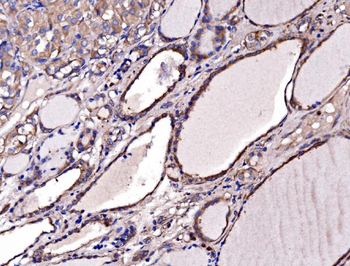 Anti-Gephyrin/GPHN Antibody