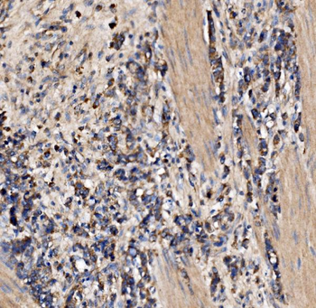 Anti-Gephyrin/GPHN Antibody