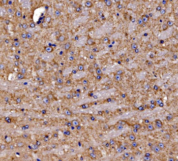 Anti-Gephyrin/GPHN Antibody