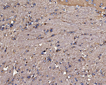Anti-Gephyrin/GPHN Antibody
