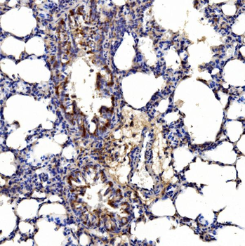 Anti-Gephyrin/GPHN Antibody