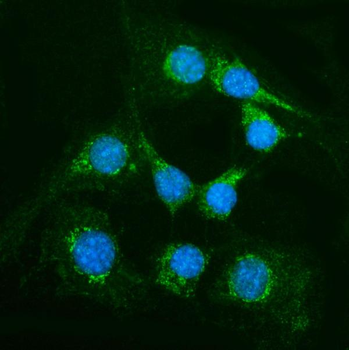 Anti-Alanine Transaminase/Gpt Antibody