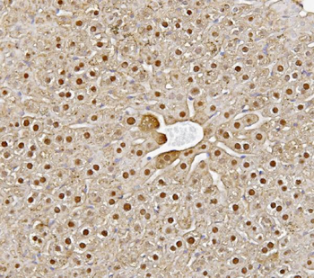 Anti-Alanine Transaminase/Gpt Antibody
