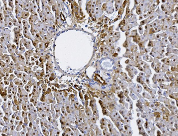 Anti-Alanine Transaminase/Gpt Antibody