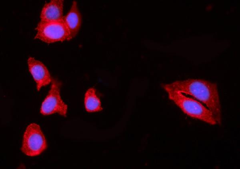 Anti-HIP1R Antibody