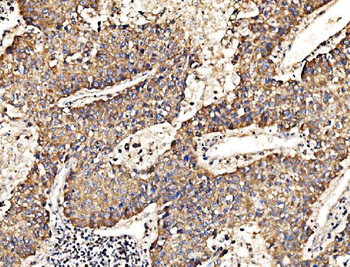 Anti-HIP1R Antibody