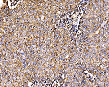 Anti-HIP1R Antibody