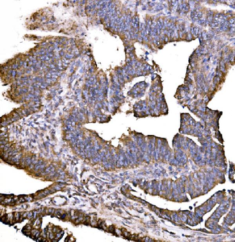 Anti-HIP1R Antibody