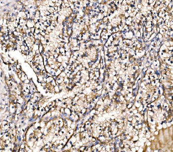 Anti-HIP1R Antibody