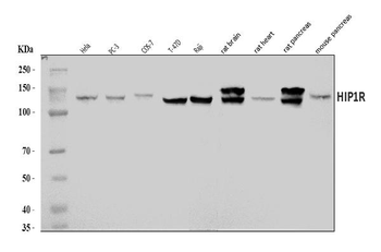 Anti-HIP1R Antibody