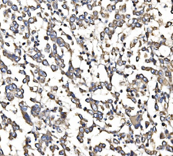 Anti-5HT1B/HTR1B Antibody