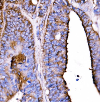 Anti-5HT1B/HTR1B Antibody