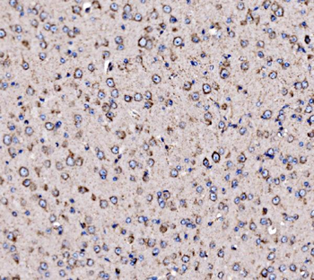 Anti-5HT1B/HTR1B Antibody