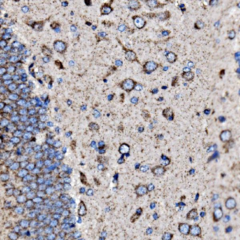 Anti-5HT1B/HTR1B Antibody