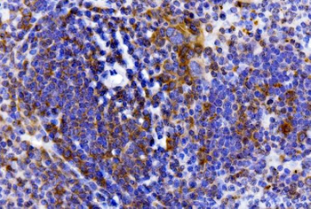 Anti-IL-2 Receptor alpha/Il2ra Antibody