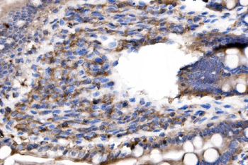 Anti-IL-2 Receptor alpha/Il2ra Antibody