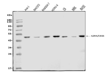Anti-IL-2 Receptor alpha/Il2ra Antibody