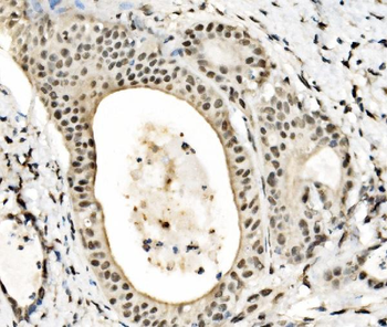 Anti-JUNB Antibody