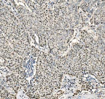 Anti-JUNB Antibody