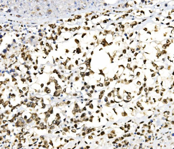 Anti-JUNB Antibody
