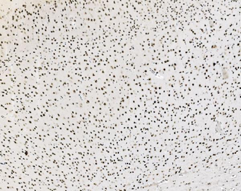 Anti-JUNB Antibody