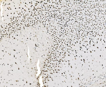 Anti-JUNB Antibody