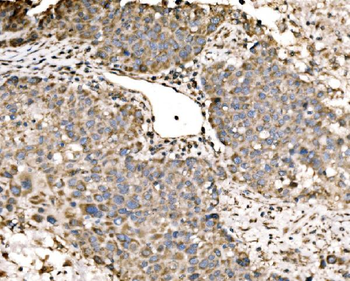 Anti-LACTB Antibody