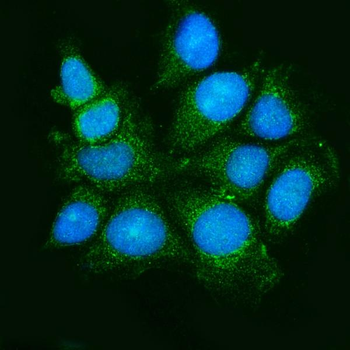 Anti-ASK1/MAP3K5 Antibody