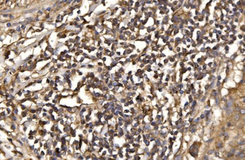 Anti-ASK1/MAP3K5 Antibody