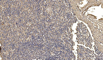 Anti-ASK1/MAP3K5 Antibody