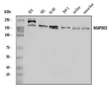 Anti-ASK1/MAP3K5 Antibody