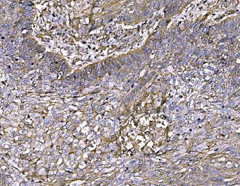 Anti-FAM129B/NIBAN2 Antibody