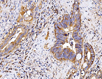 Anti-P2X7/P2RX7 Antibody