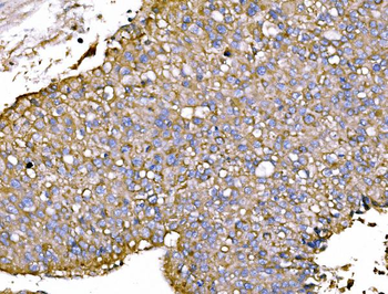 Anti-P2X7/P2RX7 Antibody