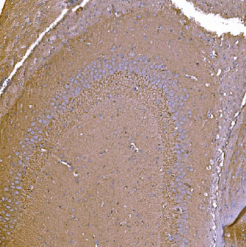 Anti-P2X7/P2RX7 Antibody