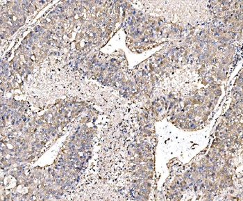 PAK1 Antibody