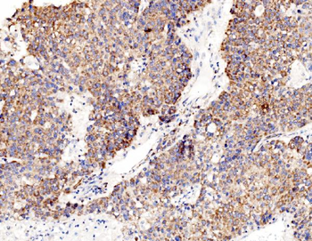 Anti-RPL8 Antibody