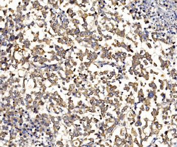 Anti-RPL8 Antibody