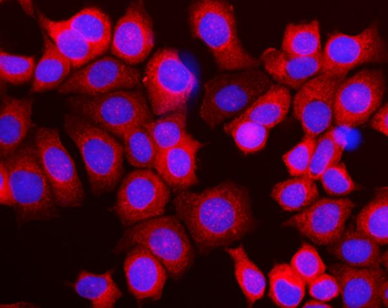 Anti-RPL10 Antibody