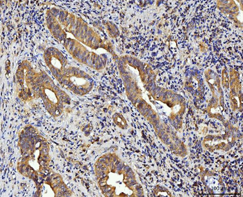 Anti-RPL10 Antibody
