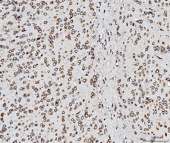 Anti-RPL10 Antibody