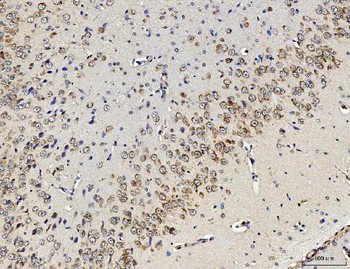 Anti-RPL10 Antibody