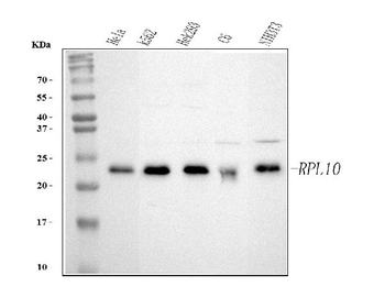 Anti-RPL10 Antibody